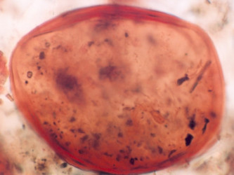 Pylové zrno modřínu ve fosilním materiálu. Foto: V. Jankovská